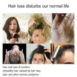 200ml-Disaar-Professional-Anti-hair-Loss-Shampoo-Preventing-Hair-Loss-Chinese-Hair-Growth-Product-Hair-Treatment.jpg_q50 (4)